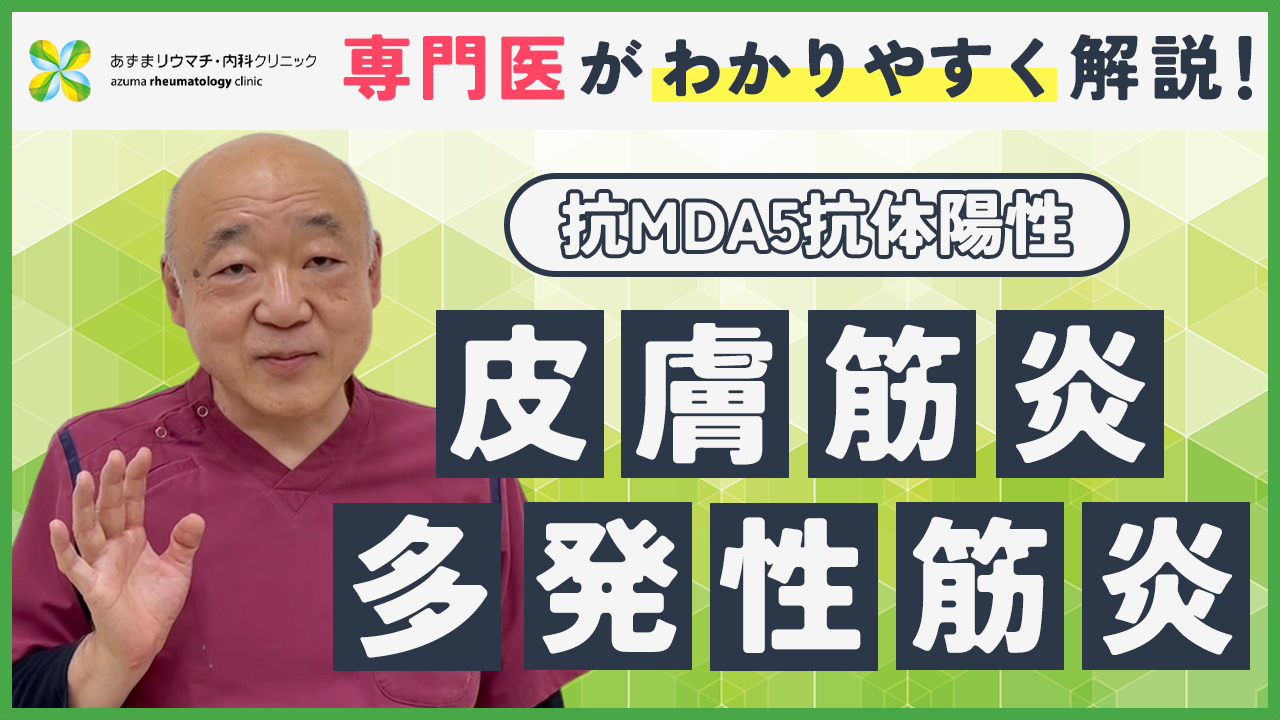 皮膚筋炎、多発性筋炎について（特に抗MDA5抗体が陽性の場合について詳しく解説いたします）